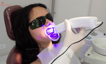How French Patients Can Save Thousands on Quality Dental Implants in Turkey?